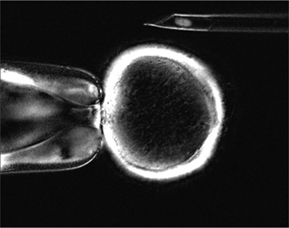Klónozáshoz előkészítik a petesejtet a sejtmag eltávolításával (enukleáció)
